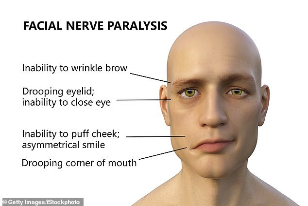 The condition has been linked to Covid - patients have a 0.08 percent risk of developing it