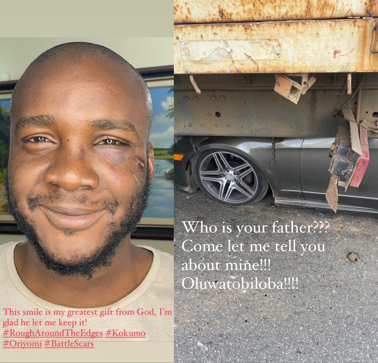 "Someone survived this?" Shock as man shares testimony of how he survived car accident