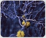Coat of proteins makes viruses more infectious and facilitates plaque formation in Alzheimer's