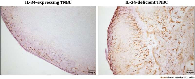 Root of triple negative breast cancer immunosuppression and chemoresistance revealed