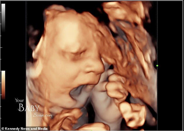 Unborn baby boy stuns parents when a 4D scan shows him giving them the middle finger ?(Photos)