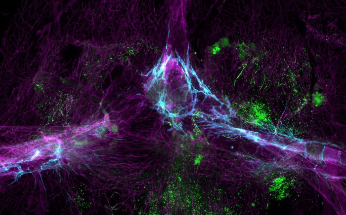 Micrograph showing close up of a mouse brain at the confluence of dural sinuses with meningeal lymphatic vessels and immune cell