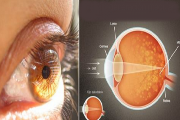 This Ingredient Increases Vision by Up to 97%