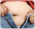Weight loss surgery widely underutilized among young patients with severe obesity