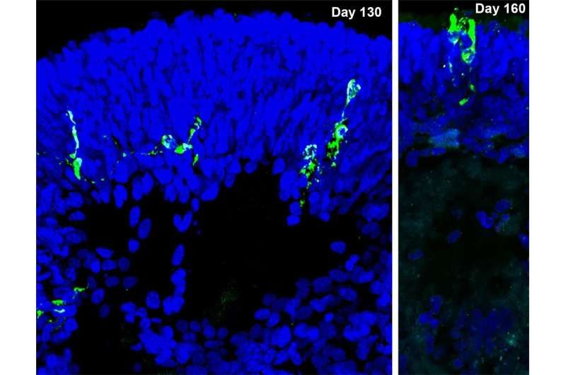 SARS-CoV-2 infects and replicates in photoreceptor and retinal ganglion cells of human retinal organoids