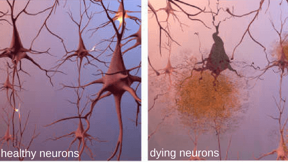 healthy-neurons
