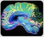 Growing understanding of neuroplasticity could drive development of new therapeutic interventions