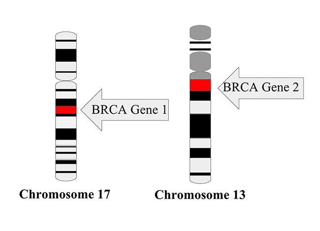 Chromosome 17 with BRCA Gene 1 and Chromosome 13 with BRCA gene 2