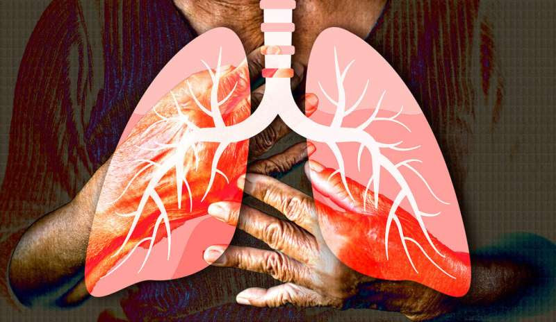 Researchers create cellular blueprint of healthy lungs