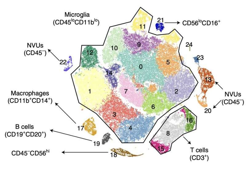 Study unveils pro-inflammatory interactions in drug-resistant epilepsy