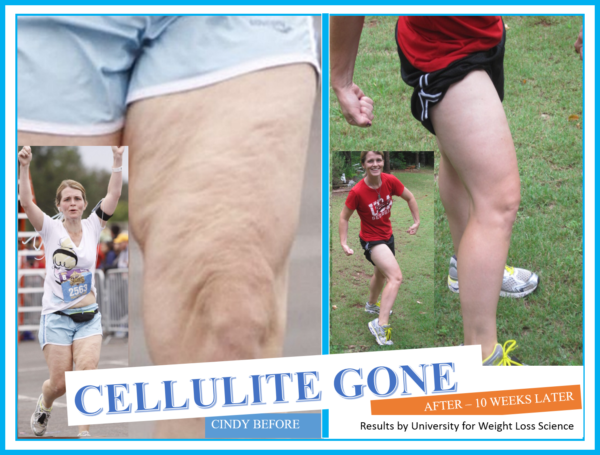 A PROGRAM THAT SIGNIFICANTLY REDUCES YOUR CELLULITE