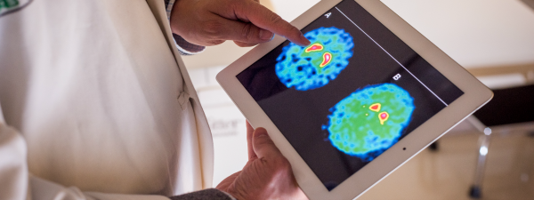 Clinician with Brain Scan