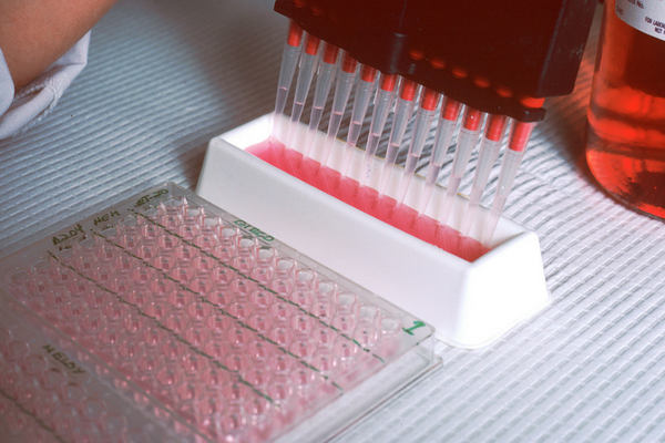 A technician's hand filling wells with a liquid for a research test. This test involves preparation of cultures in which hybrids are grown in large qu