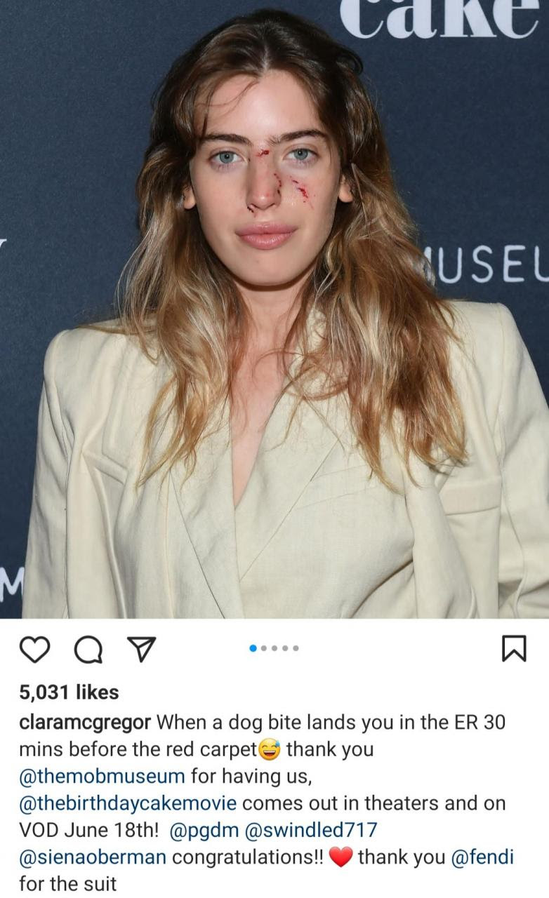 Actress Clara McGregor shows up on red carpet with bloodied face after she was attacked by dog