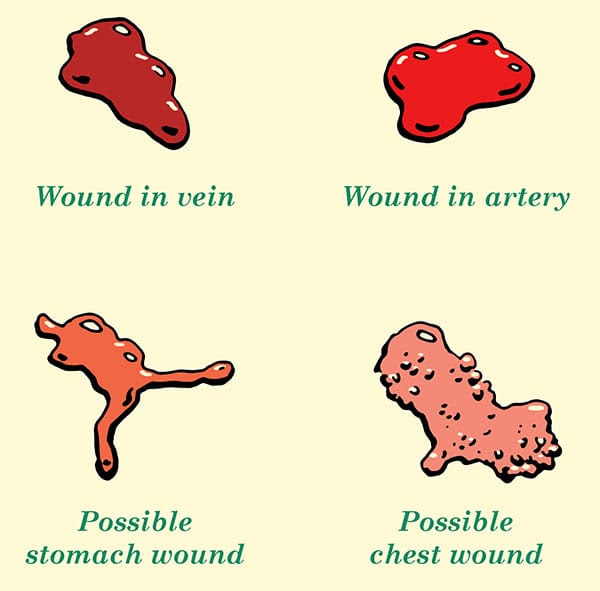 blood indicators what type of wound identification illustration