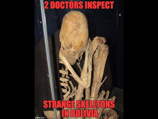 Two American Doctors Inspect Strange Ancient Skeletons In Bolivia  Sddefault