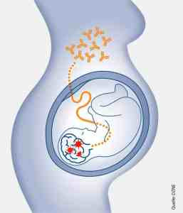 Autoantibodies in pregnancy: A cause of behavioral disorders in the child?