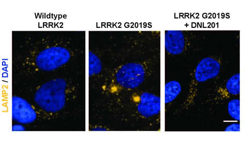 Clinical trial suggests Parkinson’s drug is safe in humans