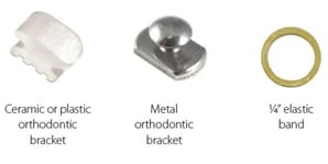 buttons, brackets, elastics.jpg