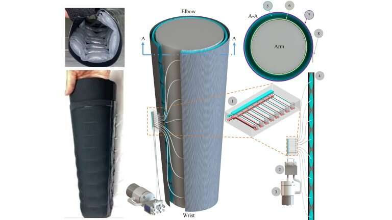 Wearable, inexpensive robotic sleeve for lymphedema treatment