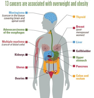Medscape CE Trends in Incidence of Cancers Associated with Overweight and Obesity — United States, 2005–2014