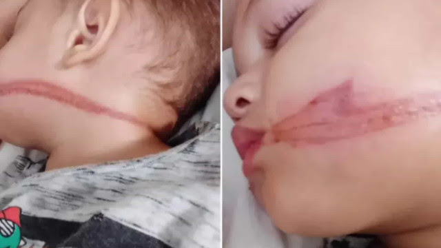 Bebês são 'chicoteados' por fiação solta entre postes no interior de SP