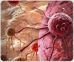 Process of removing cellular debris can fuel tumor growth in metastatic prostate cancer