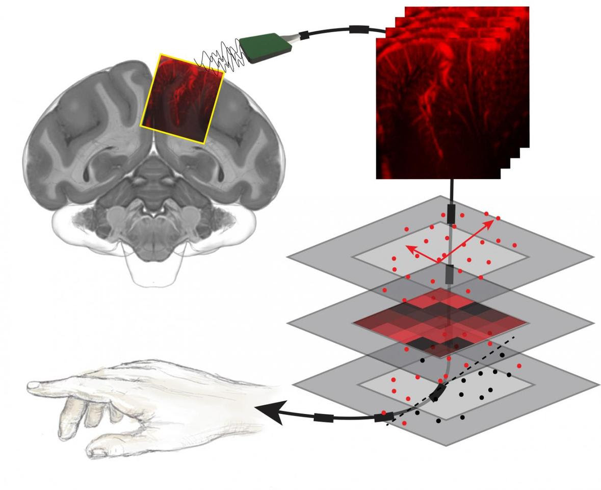 The neural activity shown in those brain images was decoded with a machine learning algorithm to correspond with movements. This process was shown to accurately predict movements even before they happened.