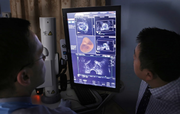 Doctors examine ultrasound and MRI images from a prostate biopsy