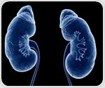 Bioactive compound limits collateral damage in the kidneys after heart attack