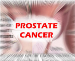  Los datos de largo plazo confirman los beneficios de la detección del cáncer de próstata - The Lancet- The Lancet  - The Lancet