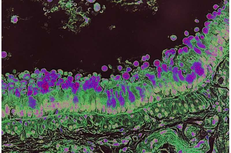 A common dietary fiber promotes allergy-like immune responses in preclinical studies