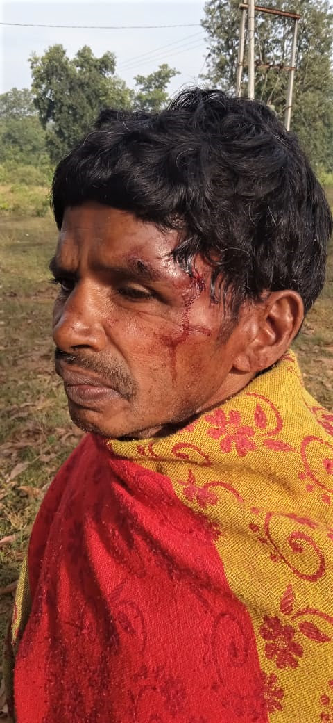  Madvi Muka sustained serious head wounds in attack in Sukma District, Chhattisgarh state, India. (Morning Star News)