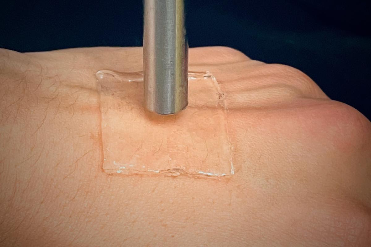 The hydrogel could also be utilized in applications such as transdermal drug delivery