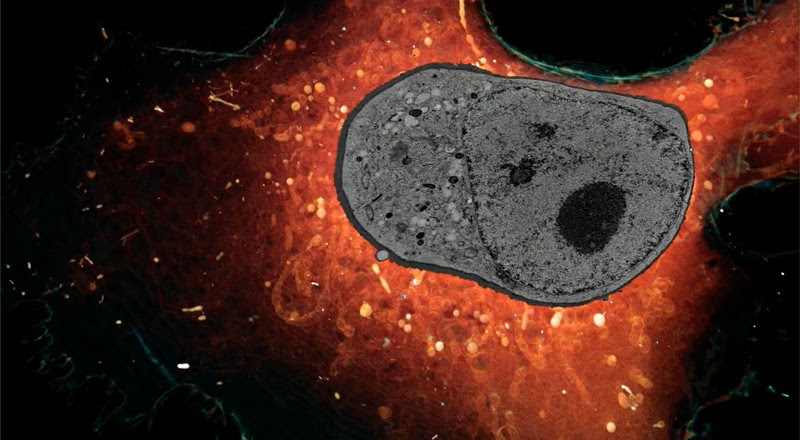 A cell imaged in two different ways: correlative cryogenic 3D super-resolution and 3D FIB-SEM of whole vitreously frozen cells