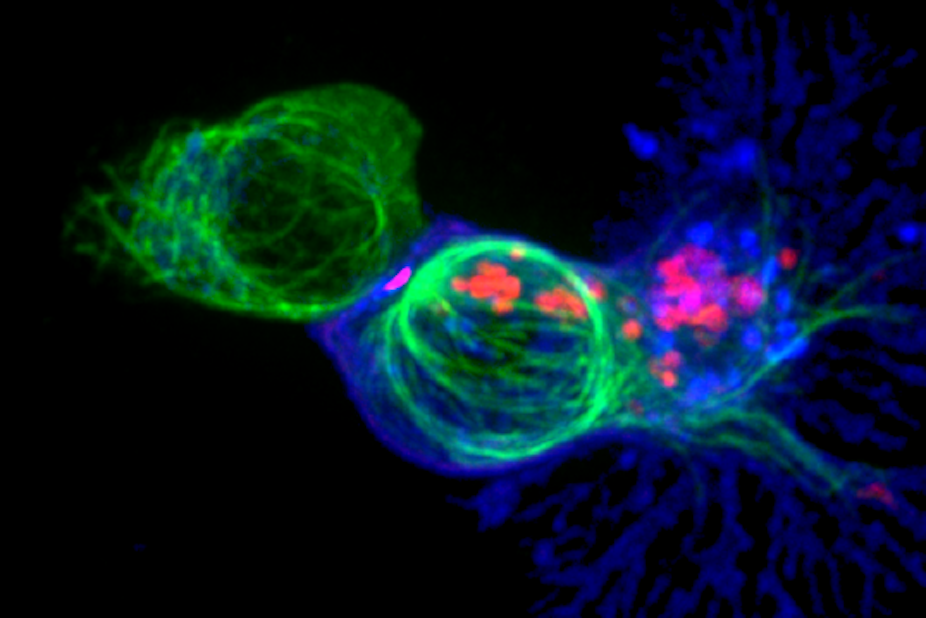 Microscopy image of T cell attacking cancer cell