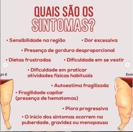 LIPEDEMA: você sabe o que é e como identificar a doença? - Prisma - R7 Como  Ser Saudável