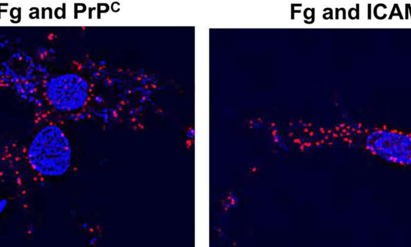 Blood plasma protein fibrinogen interacts directly with nerve cells to cause brain inflammation