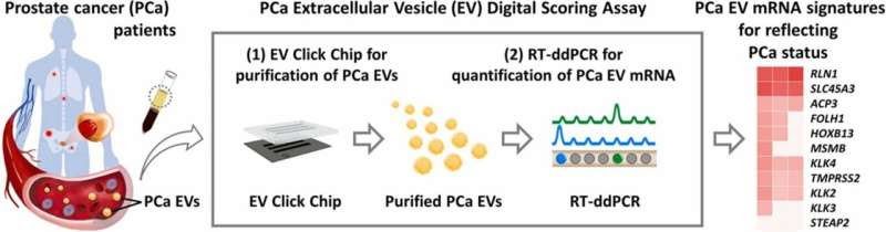 Noninvasive test detects even trace elements of prostate cancer