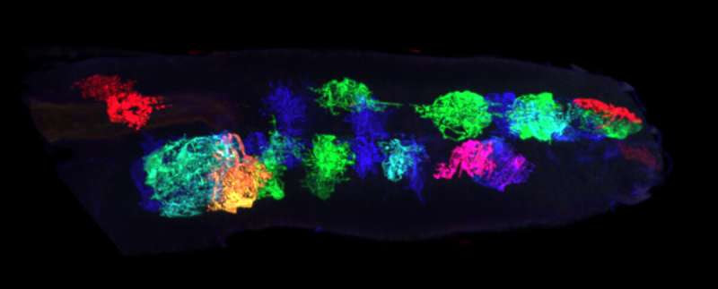 Oregon researchers identify pathway that transitions brain from plasticity to stability