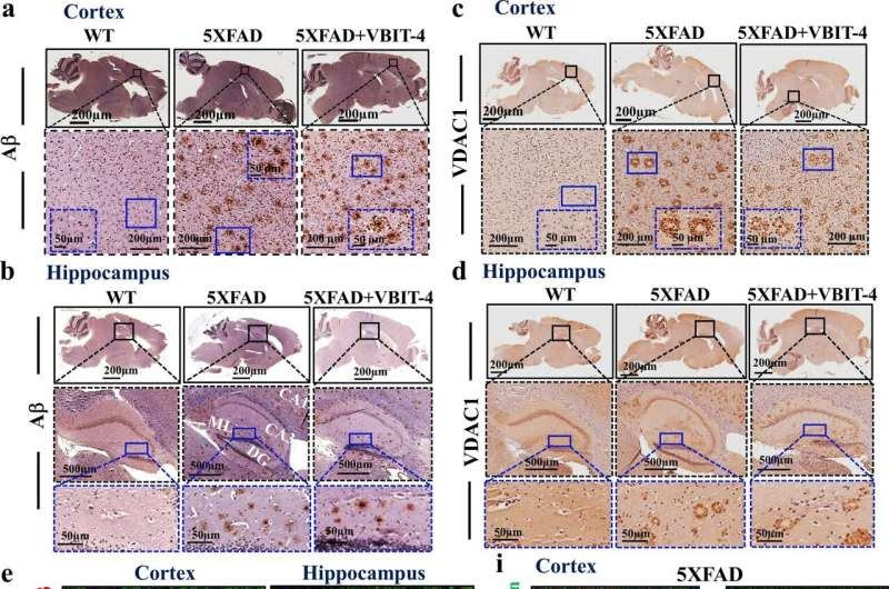 Groundbreaking approach for treating Alzheimer's shows remarkable success in mouse models