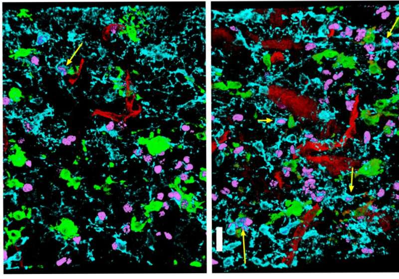 Repairing nerves requires prods of protein