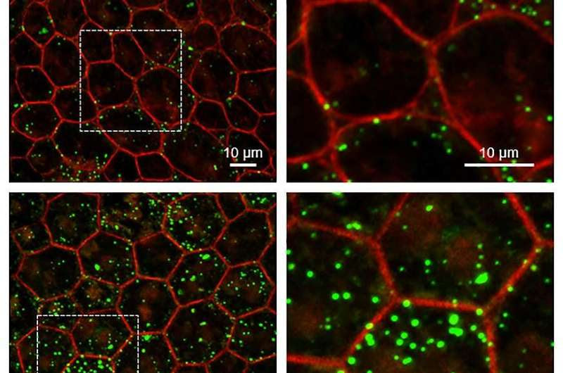 Study finds loss of 'youth' protein may drive aging in eye