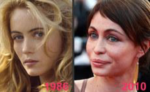 Beauté : évitez la méthode Emmanuelle Béart BEART