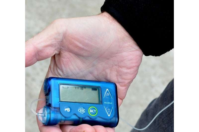 Study: Youths who use insulin pumps less at risk for diabetic retinopathy