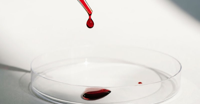 blood dripping on petri dish