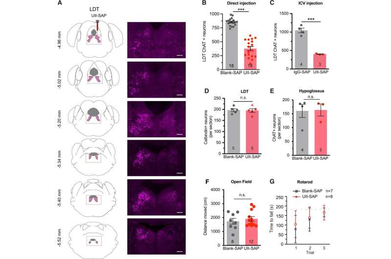 Link between sleep apnoea and dementia, according to a study in mice