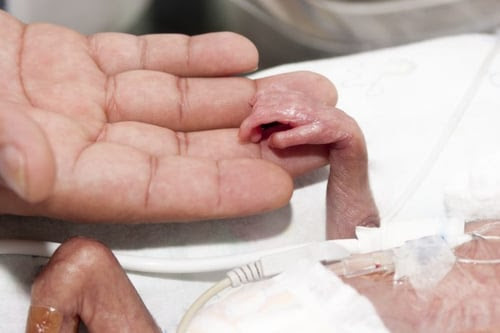 premature-baby-hand-e1516383750336