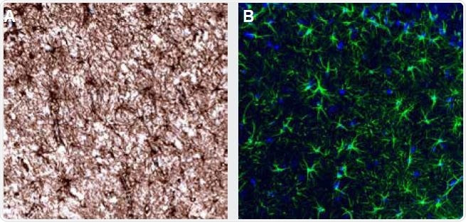 Representative staining of Glial Fibrillary Acidic Protein, GFAP, using Anti-GFAP monoclonal antibody (AMAb91033). (A) Immunohistochemical staining of the human cerebral cortex shows strong cytoplasmic positivity in astrocytes. (B) Immunofluorescence staining of rat hippocampus shows strong positivity of the astrocytes. See Table 3. for a list of Astroglial markers available from Atlas Antibodies.