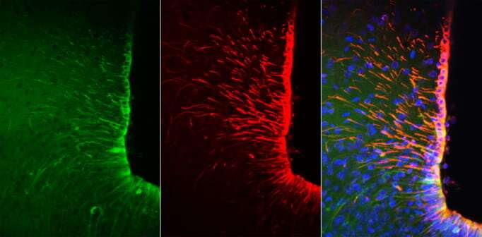 Appetite can be increased by cells in the brain